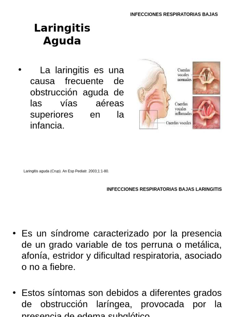 Laringitis Aguda en Niños: Causas y Tratamiento | PDF | Tos | Microbiología