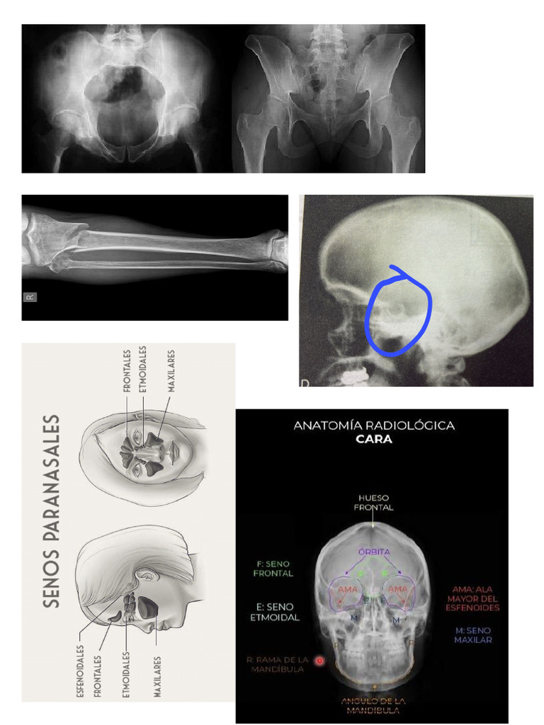 Imagenes RX | PDF