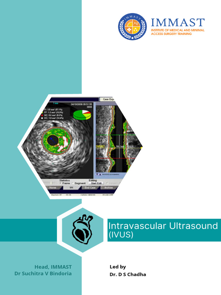IVUS daybyday | PDF | Percutaneous Coronary Intervention | Cardiology
