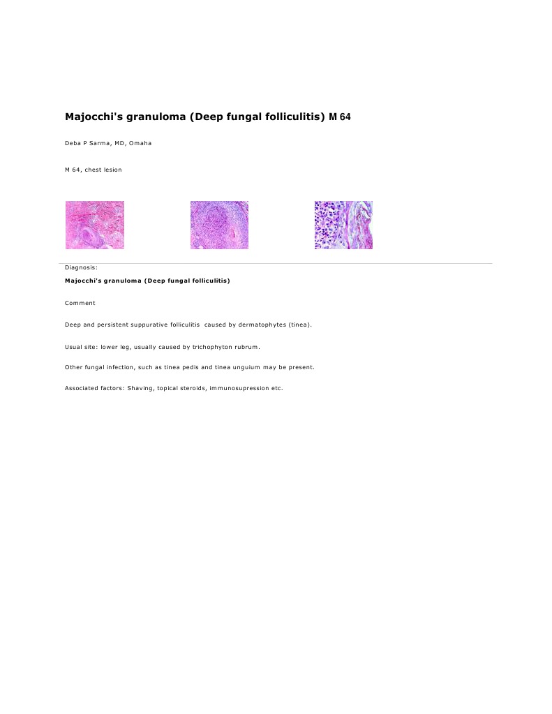 Majocchi's Granuloma on Scalp | PDF | Politics | Science & Mathematics
