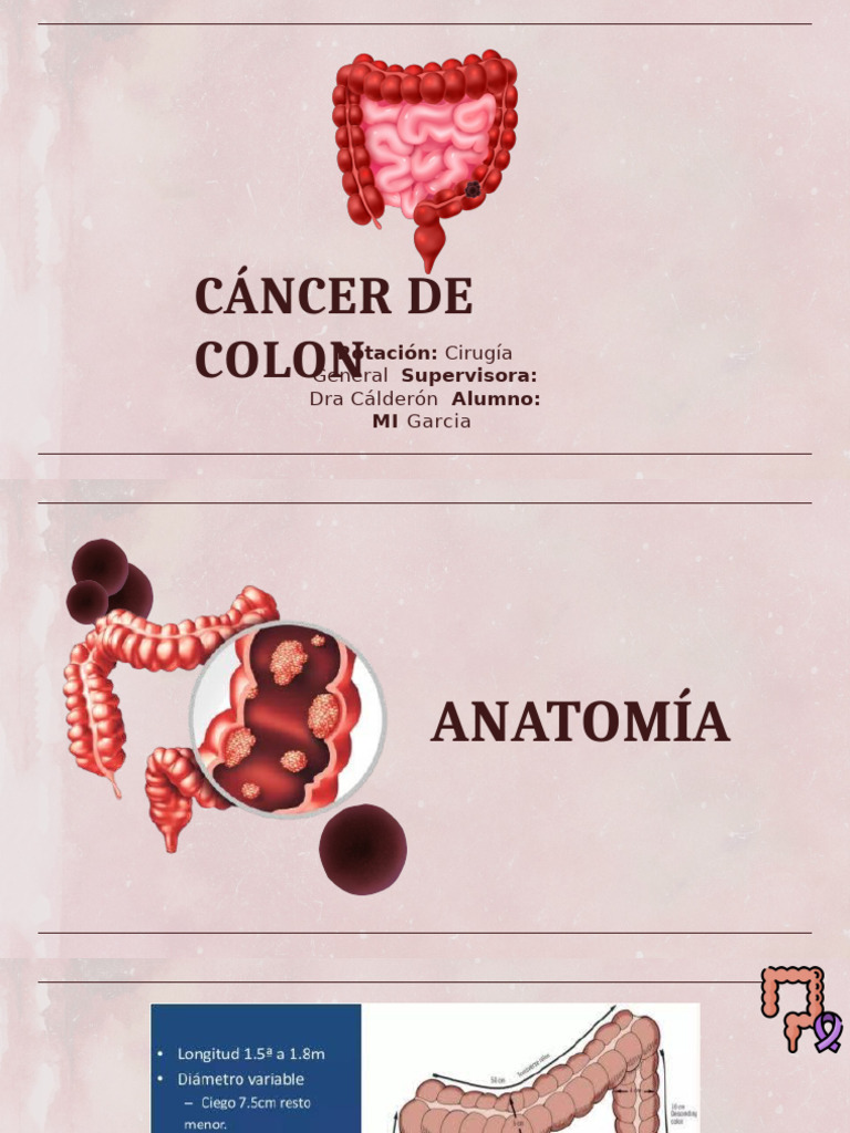 Cáncer de Colon edit_1 | PDF | Cáncer | Oncología
