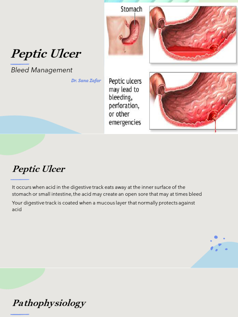 PU bleed | PDF | Gastroenterology | Diseases And Disorders