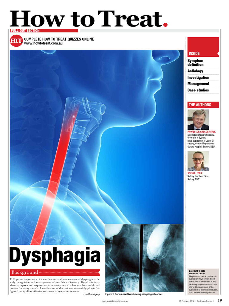 Understanding Dysphagia: Causes & Management | PDF | Esophagus ...