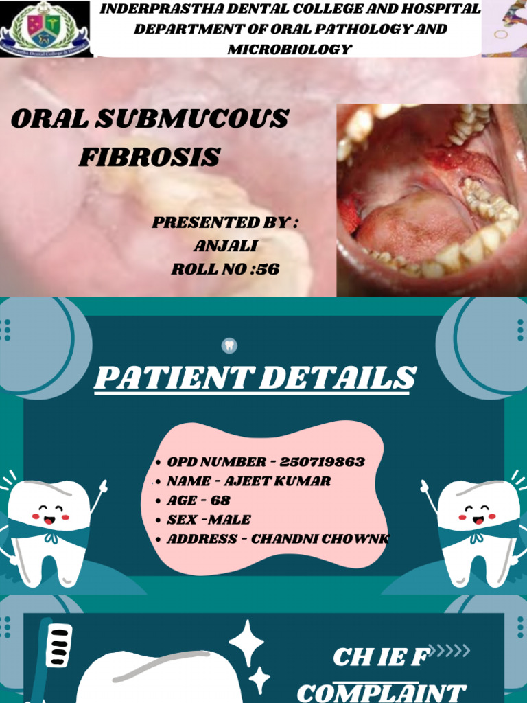Osmf - Anjali PDF | PDF