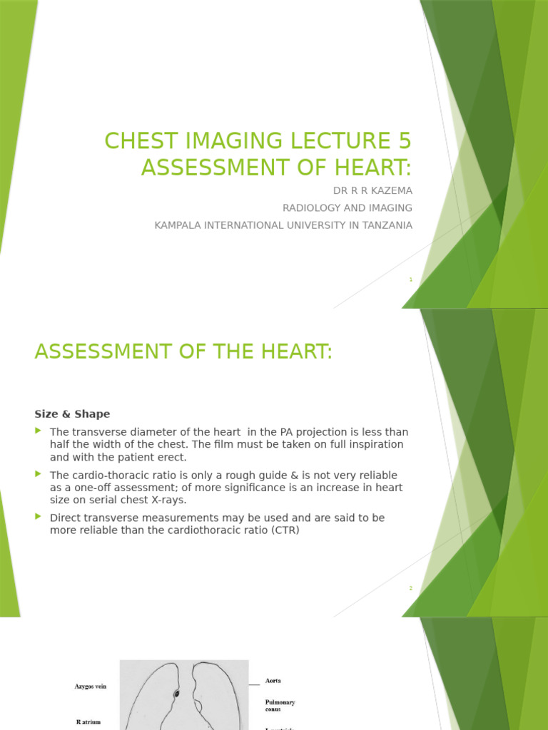 Heart Assessment in Chest Imaging | PDF | Heart | Ventricle (Heart)
