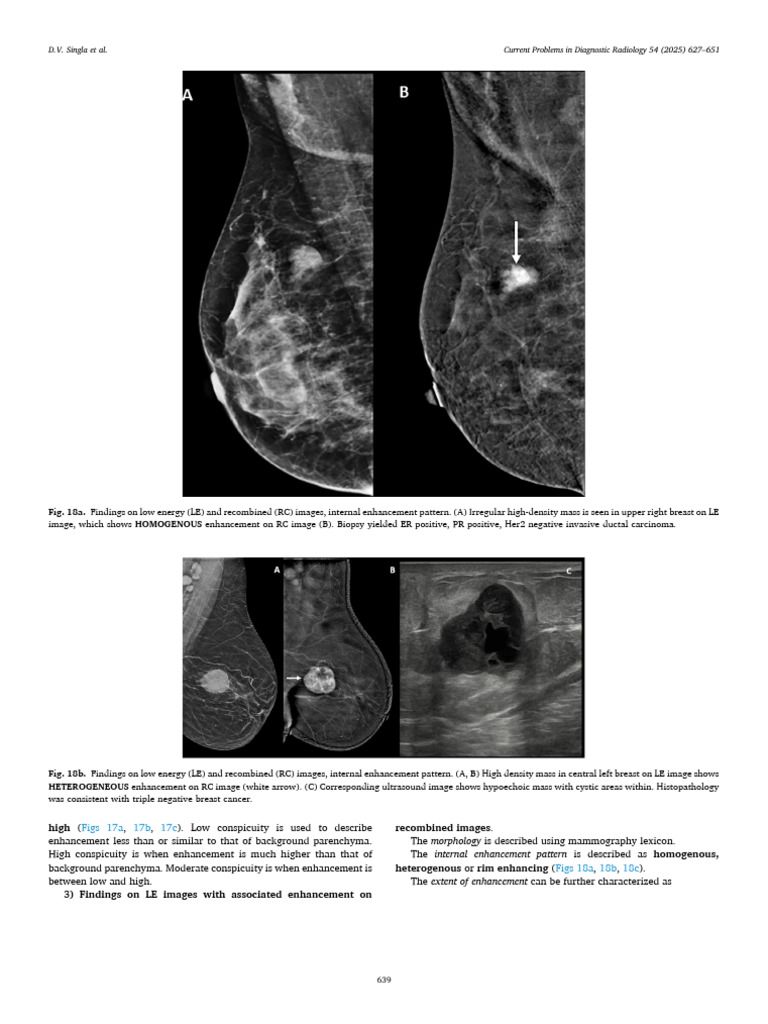 Breast Imaging Enhancement Patterns | PDF | Breast Cancer | Mammography