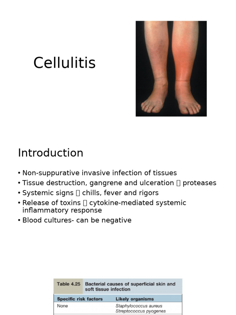 Understanding Cellulitis Types and Treatment | PDF