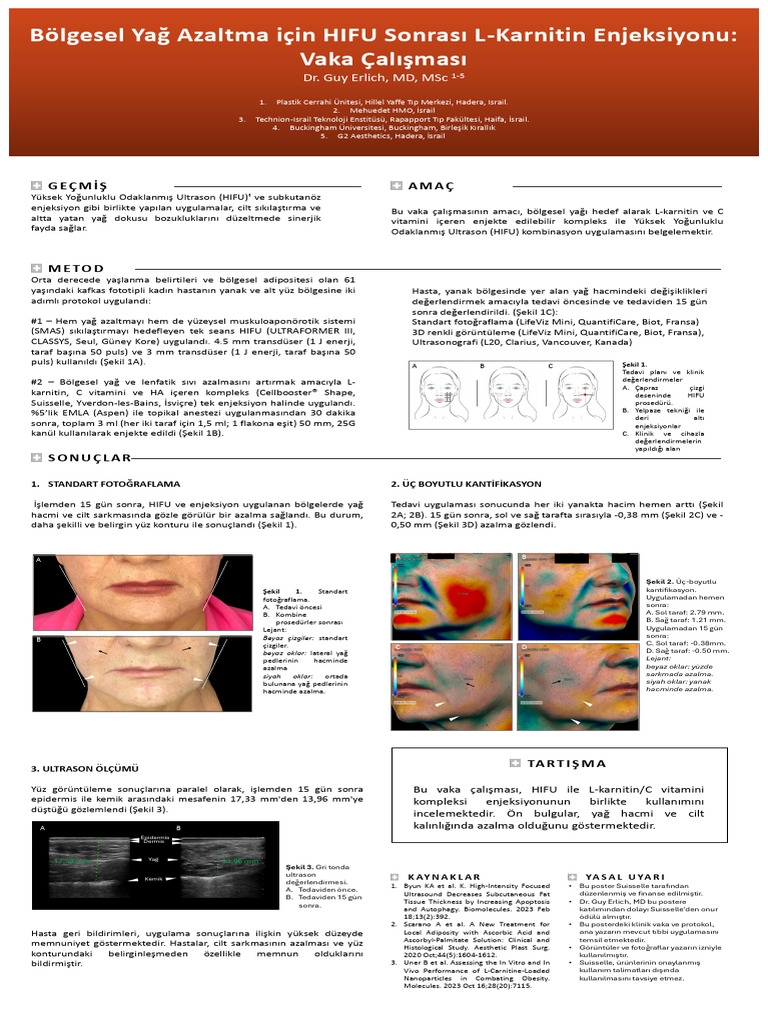 TR Poster - IMCAS 2025 - Dr. Erlich | PDF