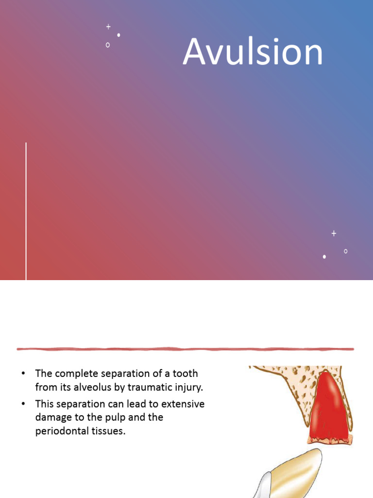 Avulsion: Tooth Reimplantation Guide | PDF | Human Tooth | Dentistry ...