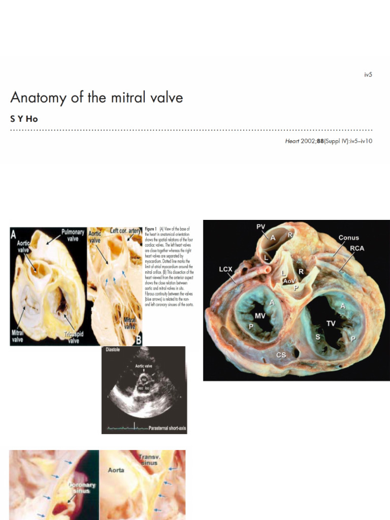 Anatomy and Histology of Mitral Valve | PDF | Heart Valve | Heart