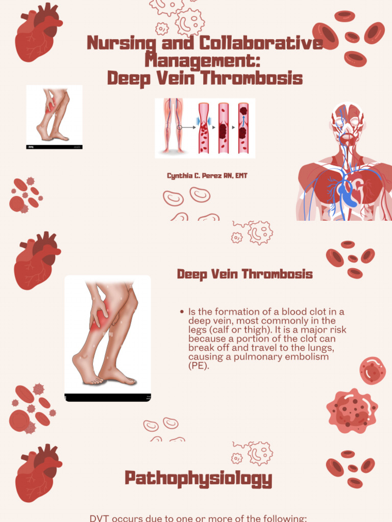 Nursing and Collaborative Management Deep Vein Thrombosis | PDF