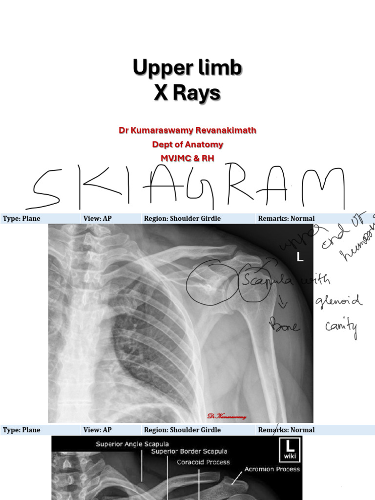 Upper Limb | PDF