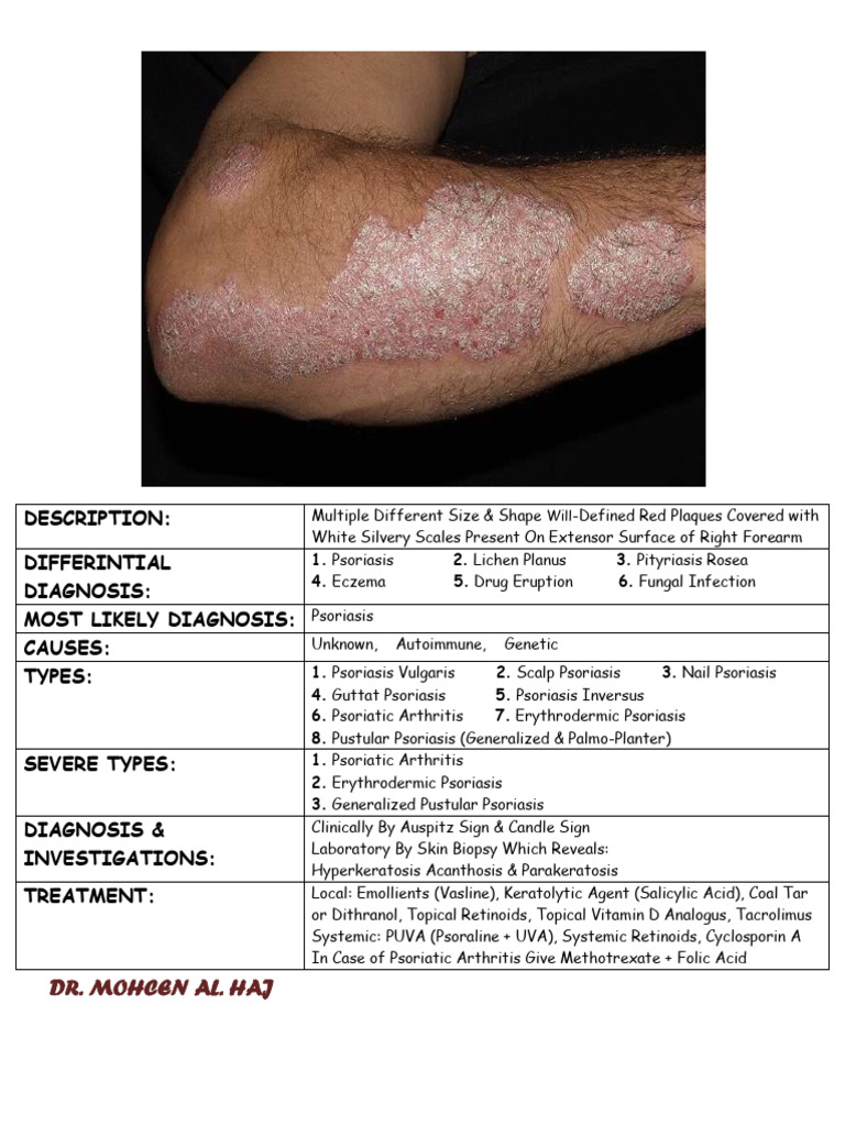 Dermatology Check List | PDF | Psoriasis | Dermatology