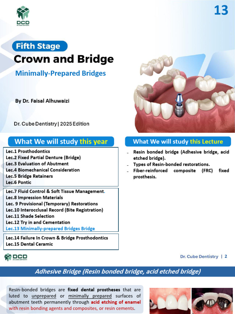 Crown5 Lec.13 Minimally Prepared Bridges | PDF | Dentistry Branches ...