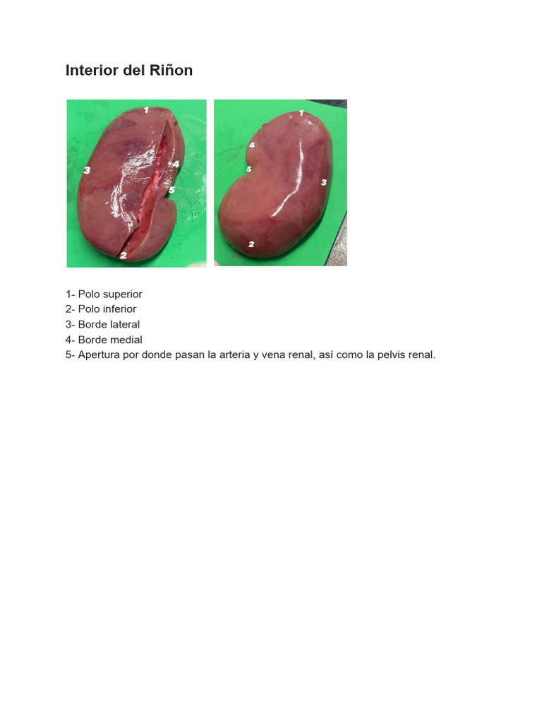 Partes Riñon Foto | PDF