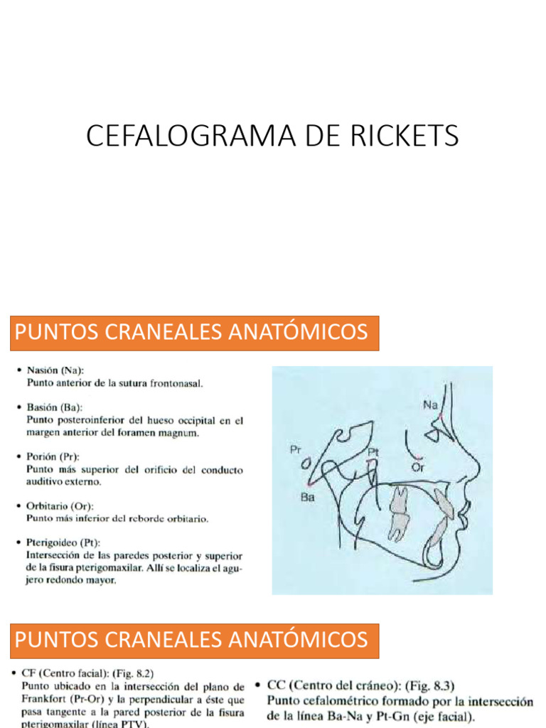 Cefalograma de Rickets | PDF