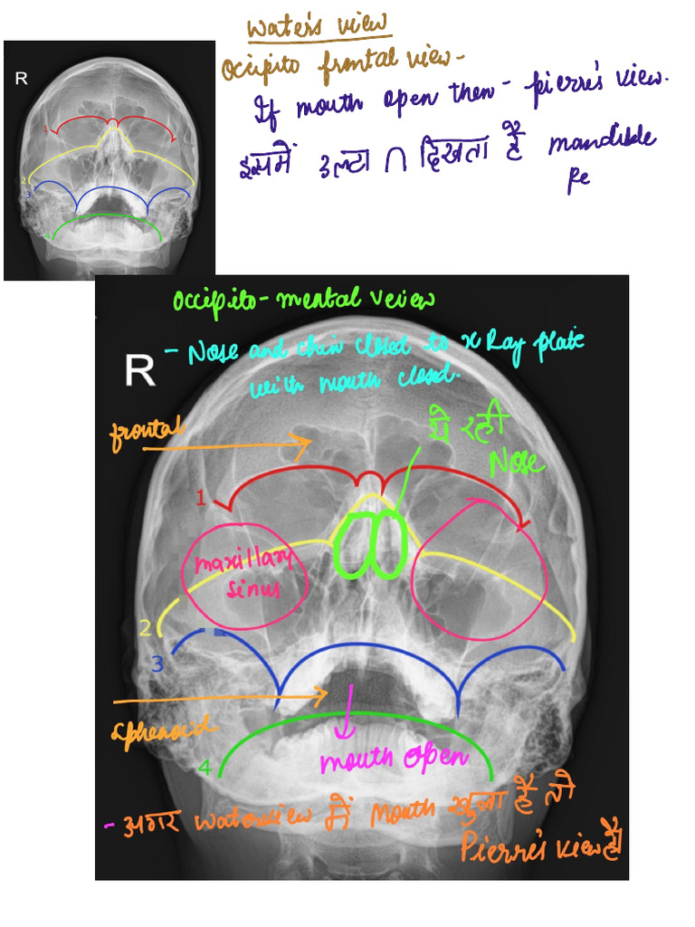 X Ray ENT Combined | PDF