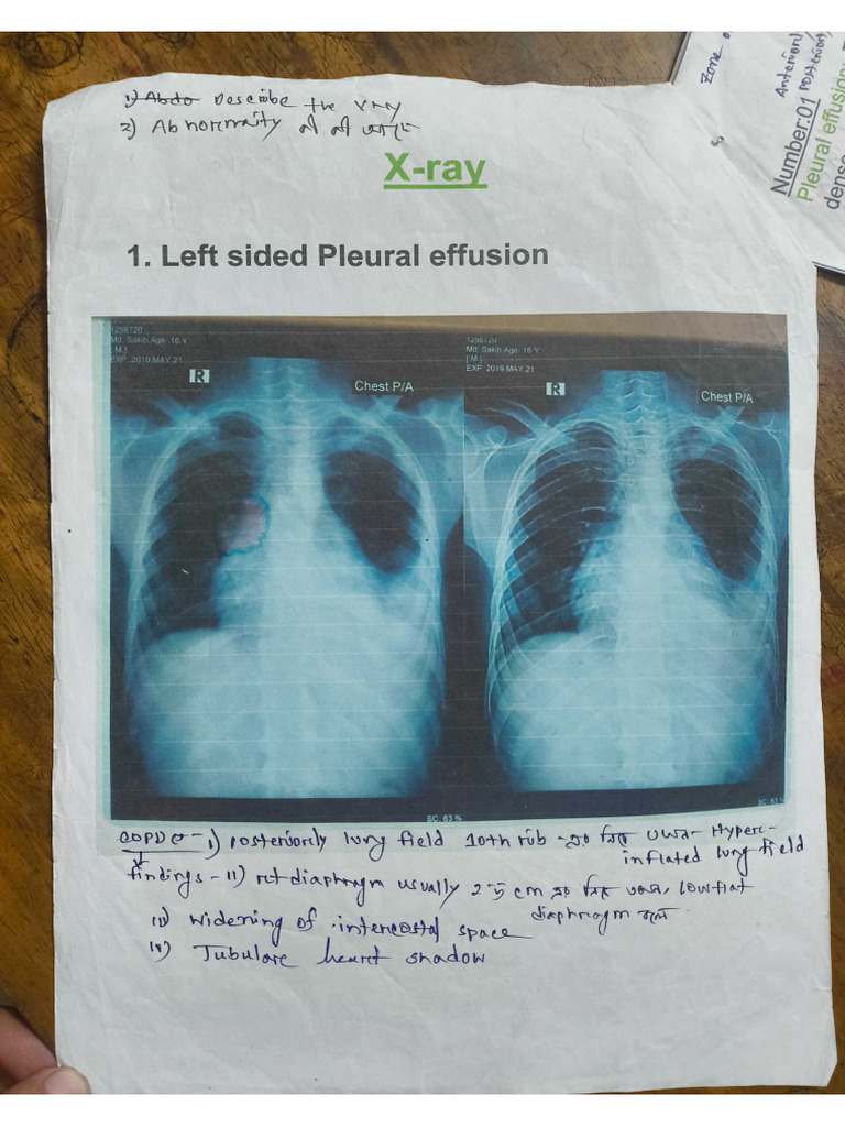 X Ray | PDF