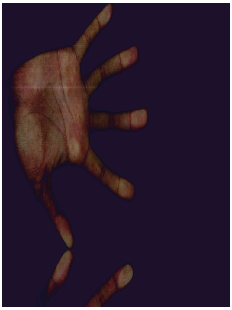 Hands | PDF