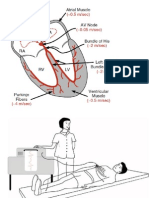 Arrhythmia