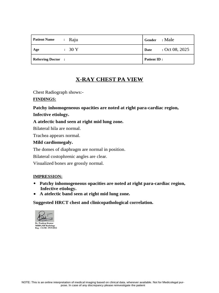 Raju CXR | PDF