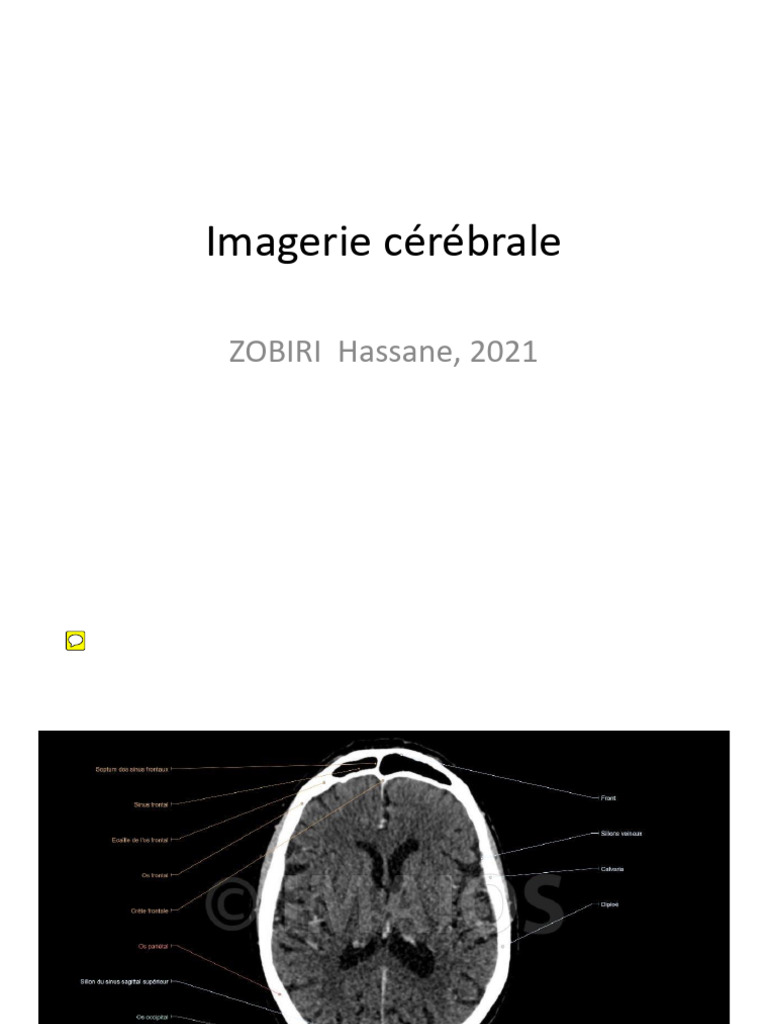 01-imagerie-c-r-brale-pdf