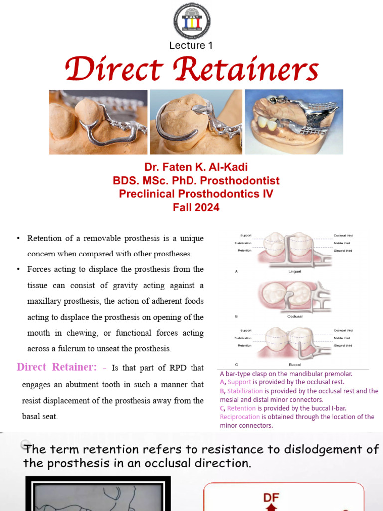 Lec1 Direct Retainer (Pcp4) | PDF | Dentures | Dentistry Branches