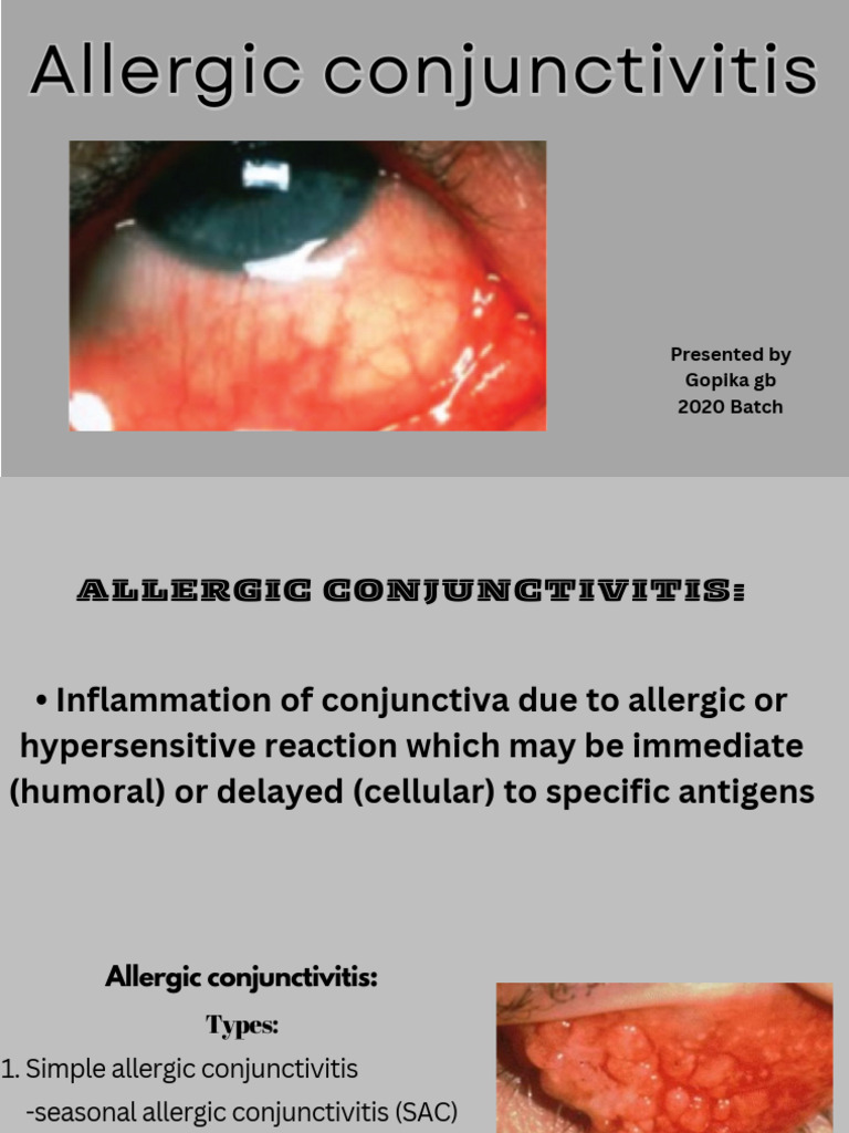 Allergic Conjunctivitis | PDF | Diseases And Disorders | Immunology