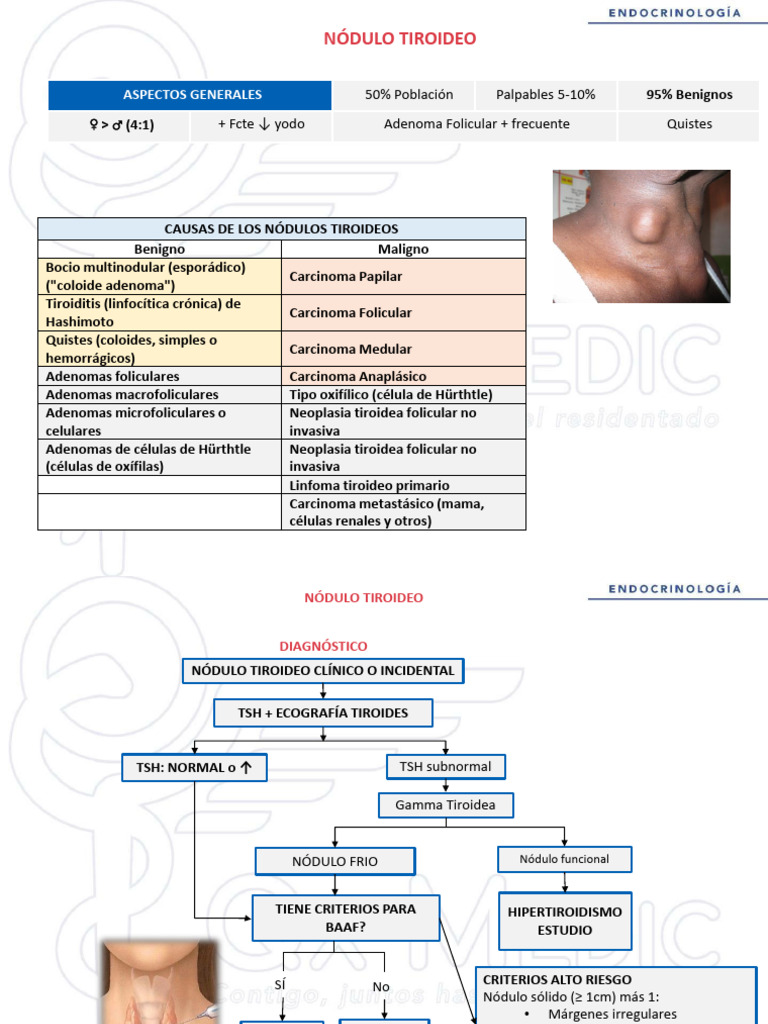 FT - EnDOCRINOLOGÍA - 1. Patología de Tiroides - Nódulo Tiroideo | PDF ...