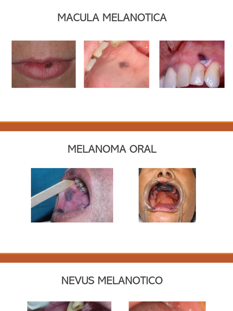 macula-pdf