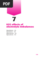 ECG Changes in Hypokalaemia | PDF | Nutrition | Diet & Nutrition