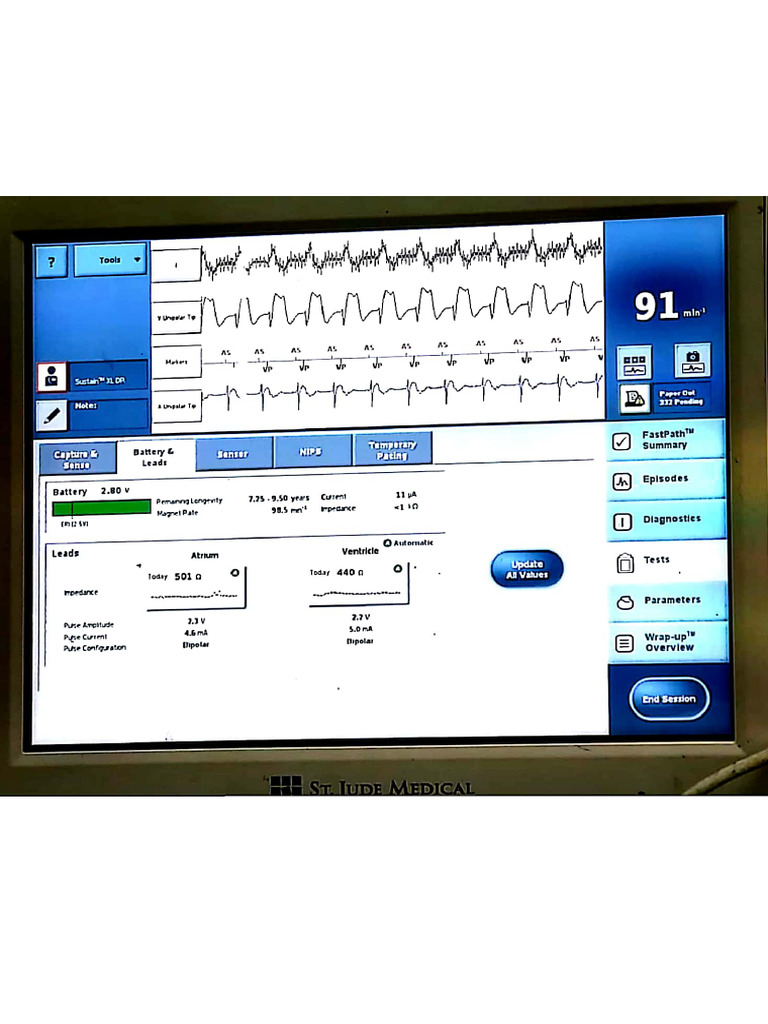 PM Case Programming | PDF