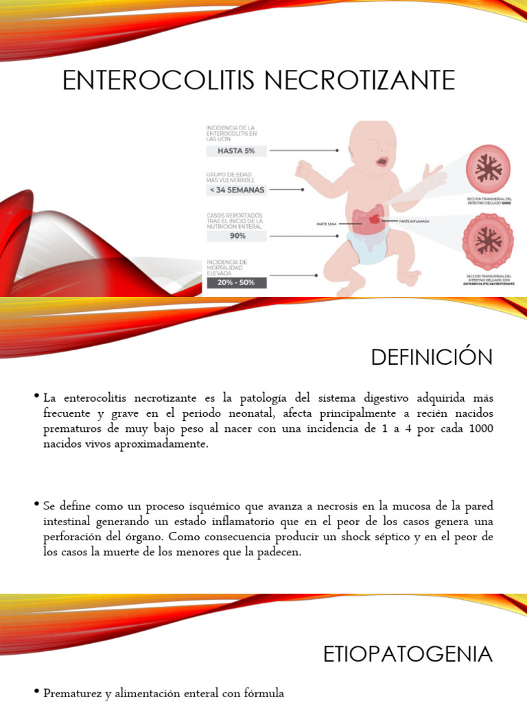Enterocolitis Necrotizante | PDF