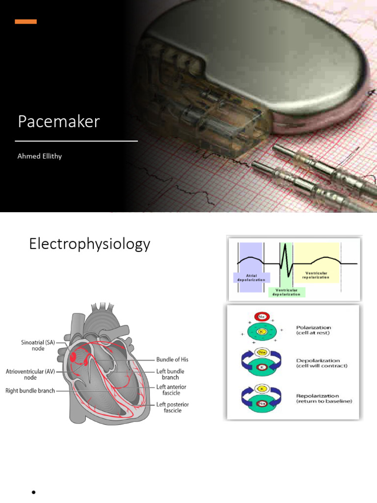 1 Pacemaker | PDF | Heart | Electrocardiography