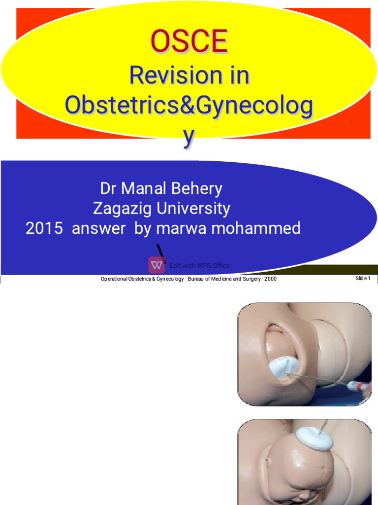 Os Ce Revision in Obstetrics and Gynecology | PDF | Childbirth ...