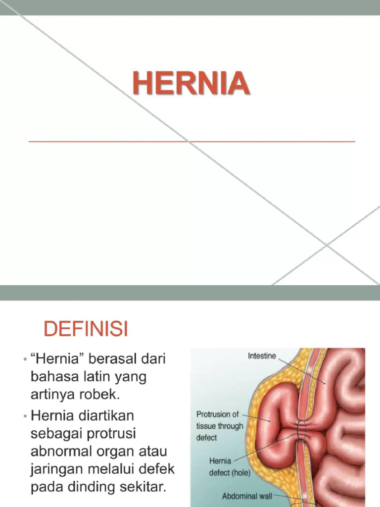 Hernia 3 | PDF
