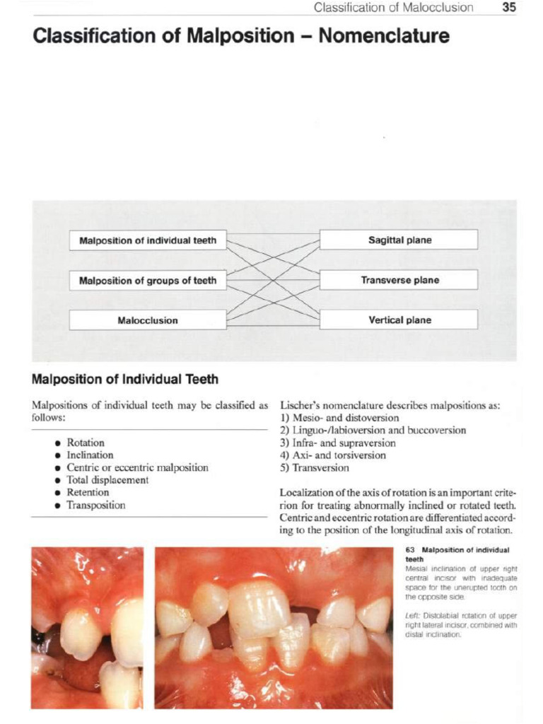 Color Atlas of Dental Medicine Orthodontic PDF | PDF