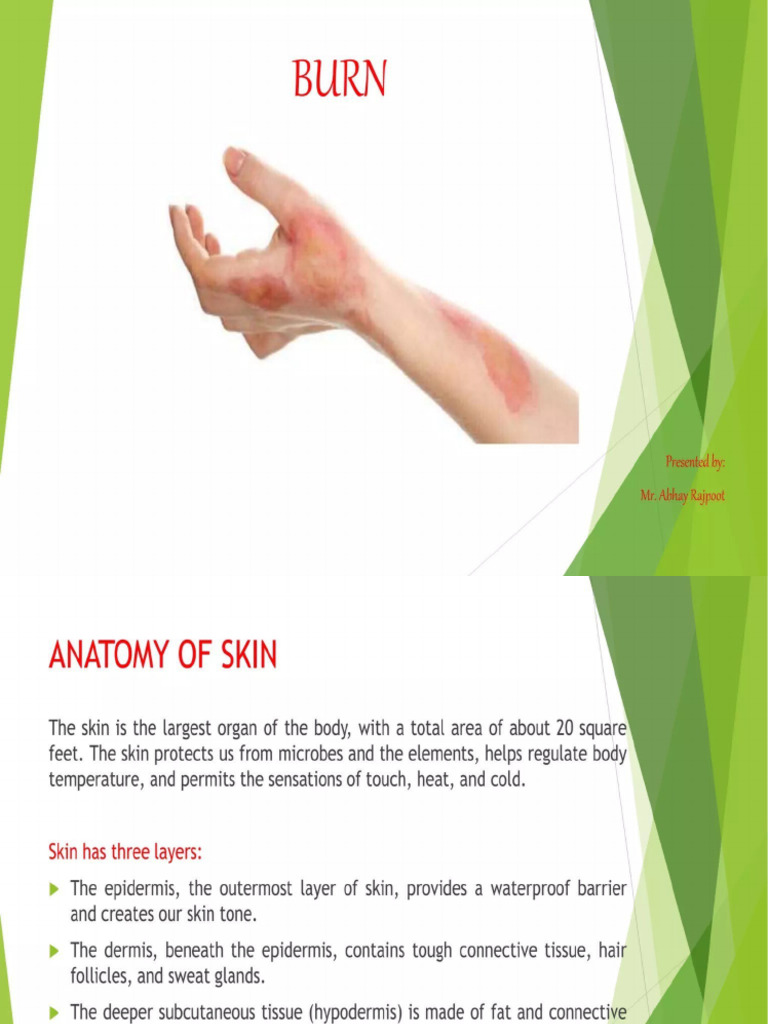 Burn | PDF