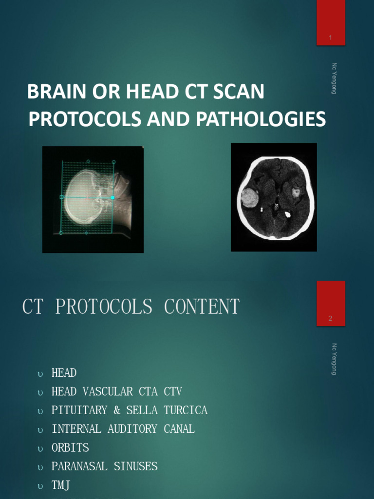 Brain CT Protocols & Pathos LV 200 | PDF | Diseases And Disorders ...