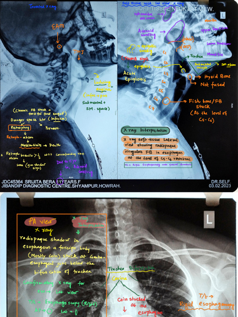 Ent X Ray - Solved | PDF