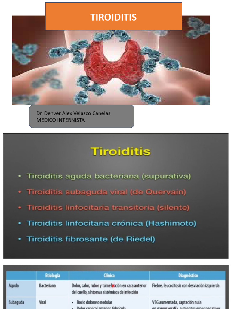TIROIDITIS | PDF | Tiroides | Hipotiroidismo