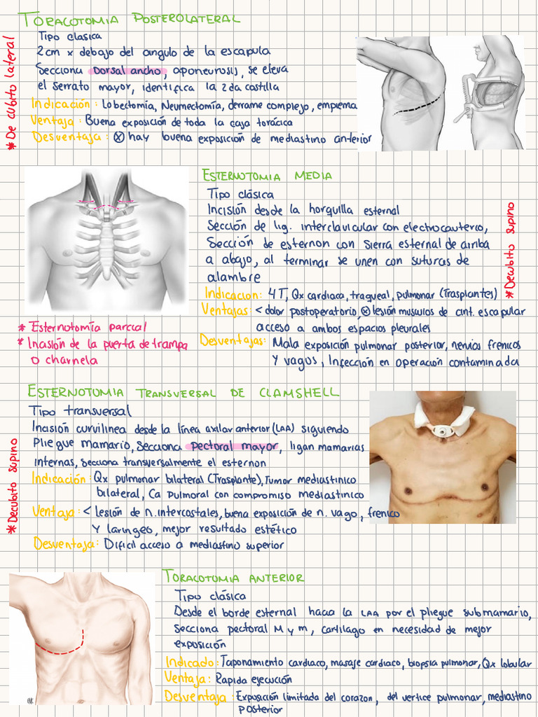 Incision Es | PDF