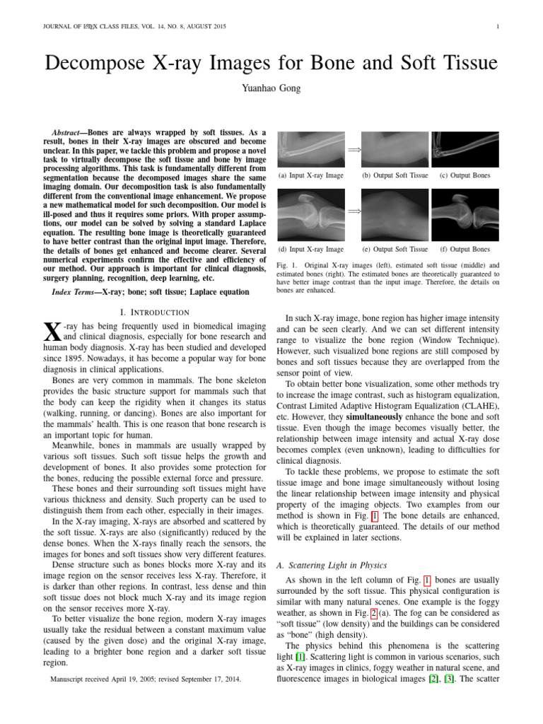 Bone and Soft Tissue Decomposition | PDF | X Ray | Image Segmentation