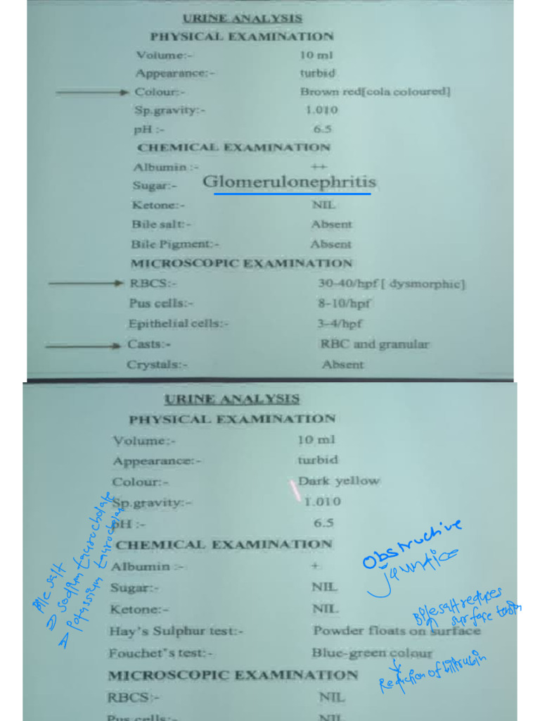 Urine- Pathology Charts 2_231010_190638 2 | PDF | Urinary System