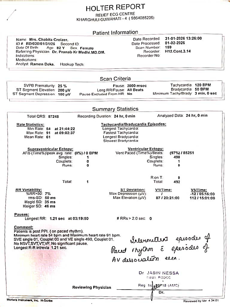 Mrs - Croizer Holter Report | PDF