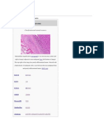 Osteosarcoma