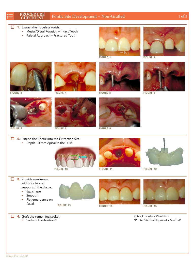 Pontic Site Development Non Grafted | PDF | Dentistry Branches | Dentistry