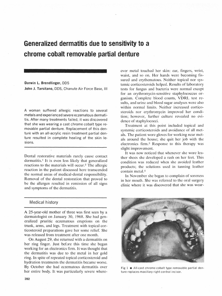 Generalized Dermatitis Due To Sensitivity To A Chrome Cobalt Removable ...