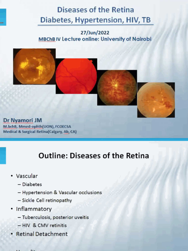 Diseases of The Retina | PDF