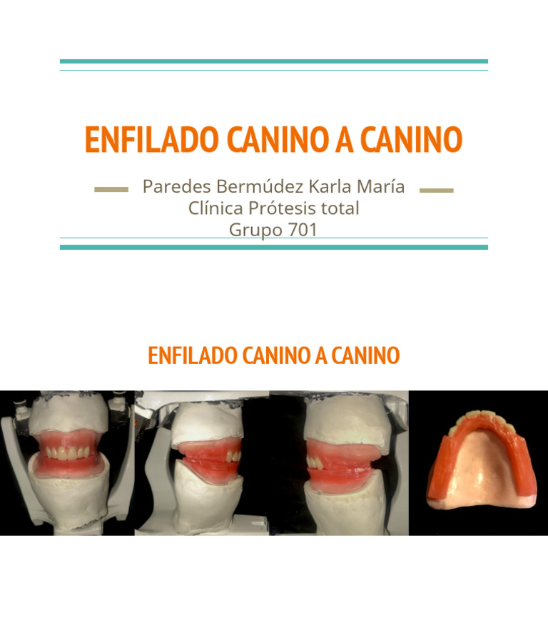 Enfilado Canino A Canino | PDF